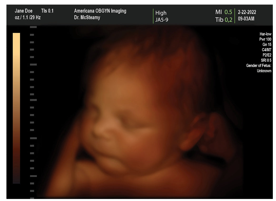 4d-and-2d-fake-ultrasound-generator-free-sonograms-fakeababy