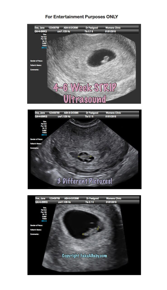 4 week vaginal ultrasound pictures