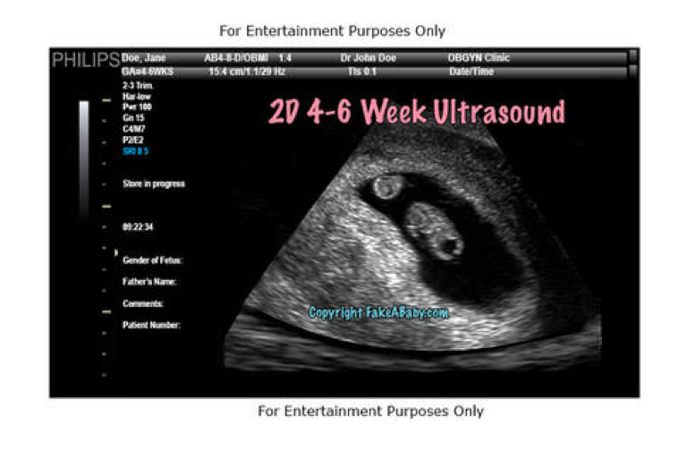 Fake a Baby's New and Improved Fake Ultrasound – FakeaBaby.com