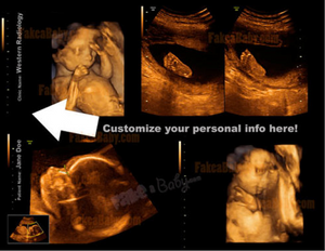 OUR NEWEST AND FRESHEST FAKE ULTRASOUNDS