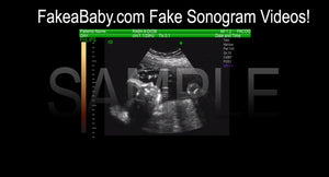 The Best Fake Ultrasound Video Prank