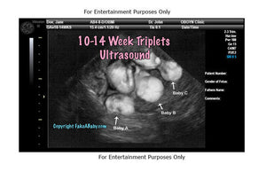 Get a Twins or Triplets Fake Ultrasound!