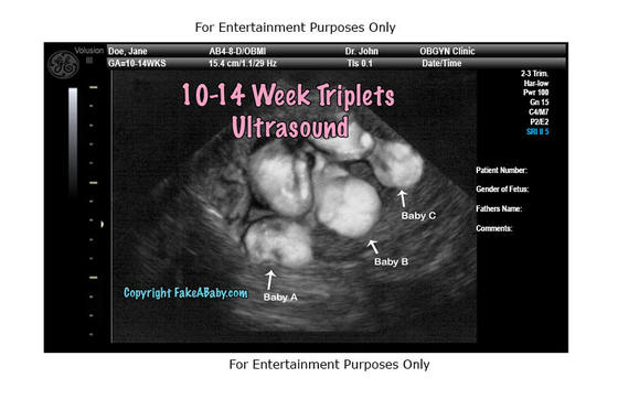 Get a Twins or Triplets Fake Ultrasound!