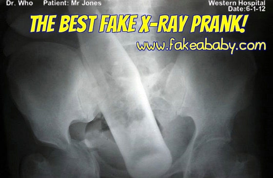 Become a Fake X-Ray Prank Expert!