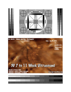 5 Outrageous Ideas For Your FAKE 3d Ultrasound