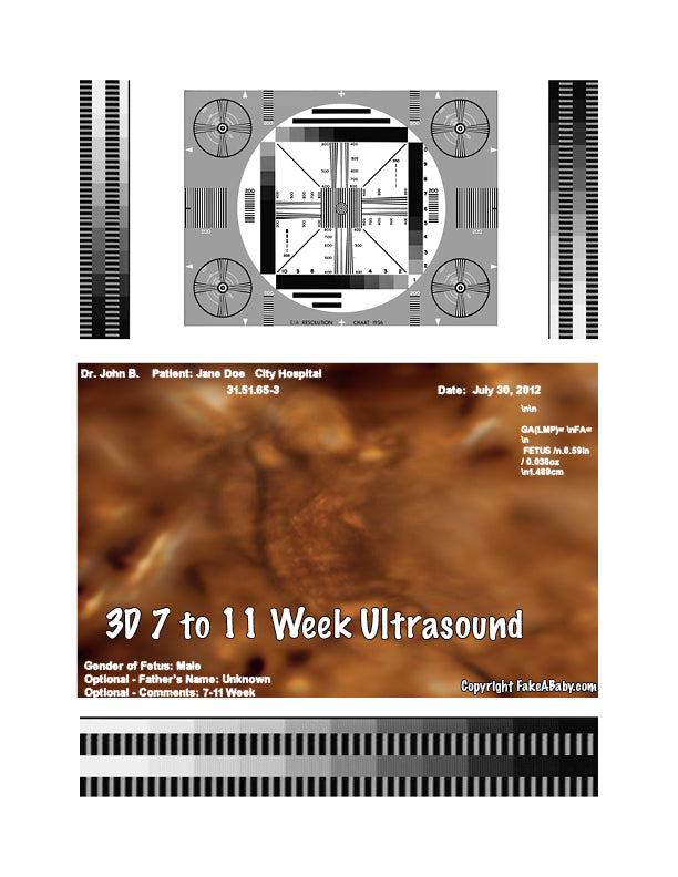 5 unerhörte Ideen für Ihren gefälschten 3D-Ultraschall