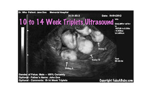 Twins or Triplets? Fake it with a Fake Ultrasound