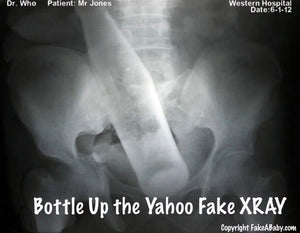 Reasons Why People Love Our Personalized Fake X-rays