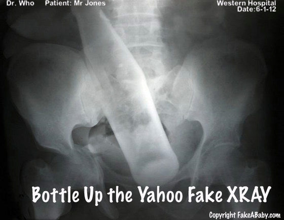 Reasons Why People Love Our Personalized Fake X-rays