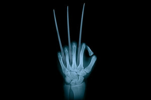 Avoid Failure in a Fake X-Ray Prank