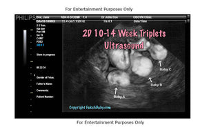 Fake Triplets Ultrasound