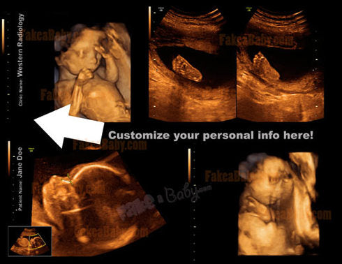 Our New, Sparklingly Modernistic Fake Ultrasound Designs