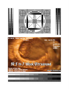 Wreak Vengeance with a Classic 3D Fake Ultrasound