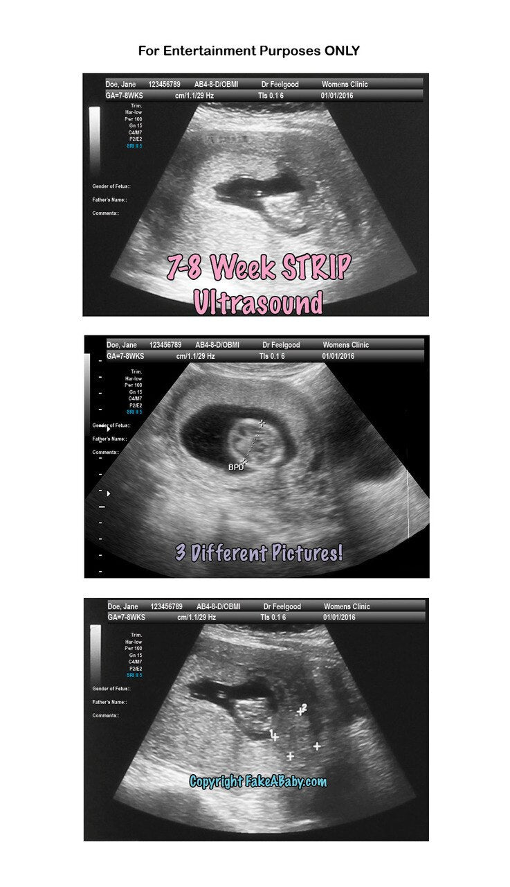 7 week 3d ultrasound